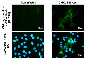 Anti-Chikungunya virus nsP4 antibody [HL2582] used in Immunocytochemistry/ Immunofluorescence (ICC/IF). GTX638960